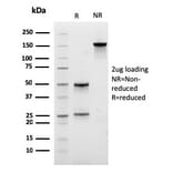 SDS-PAGE - Anti-Lambda Light Chain Antibody [rLLC/3777] - BSA and Azide free (A252170) - Antibodies.com