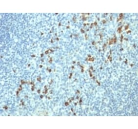 Immunohistochemistry - Anti-Lambda Light Chain Antibody [HP6054] - BSA and Azide free (A252172) - Antibodies.com