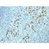 Immunohistochemistry - Anti-Lambda Light Chain Antibody [HP6054] - BSA and Azide free (A252172) - Antibodies.com