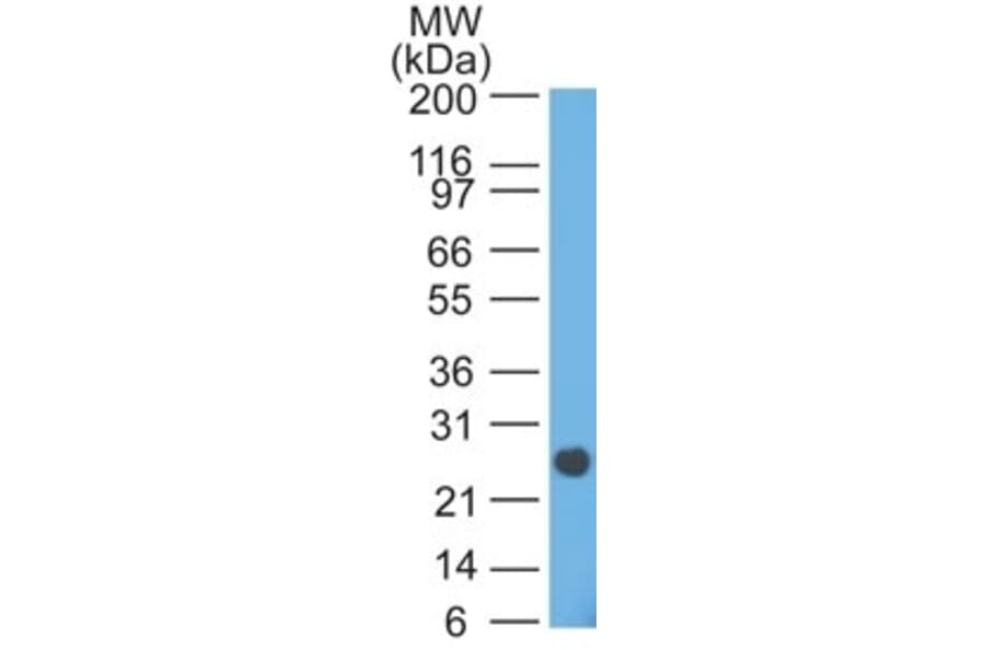Western Blot - Anti-Lambda Light Chain Antibody [HP6054] - BSA and Azide free (A252172) - Antibodies.com