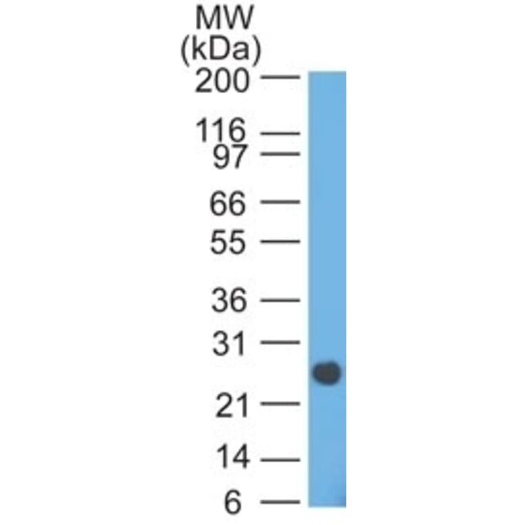 Western Blot - Anti-Lambda Light Chain Antibody [HP6054] - BSA and Azide free (A252172) - Antibodies.com
