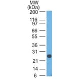 Western Blot - Anti-Lambda Light Chain Antibody [HP6054] - BSA and Azide free (A252172) - Antibodies.com