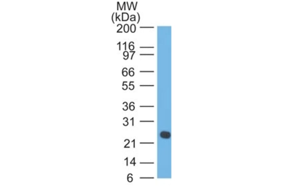 Western Blot - Anti-Lambda Light Chain Antibody [LcN-2] - BSA and Azide free (A252173) - Antibodies.com