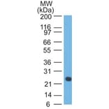 Western Blot - Anti-Lambda Light Chain Antibody [LcN-2] - BSA and Azide free (A252173) - Antibodies.com