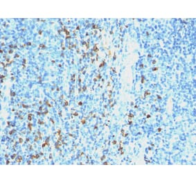 Immunohistochemistry - Anti-Lambda Light Chain Antibody [SPM559] - BSA and Azide free (A252173) - Antibodies.com