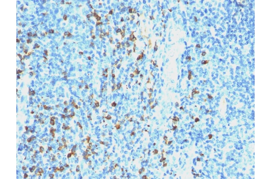 Immunohistochemistry - Anti-Lambda Light Chain Antibody [SPM559] - BSA and Azide free (A252173) - Antibodies.com