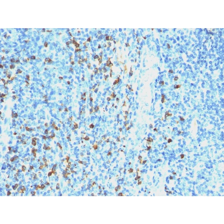 Immunohistochemistry - Anti-Lambda Light Chain Antibody [SPM559] - BSA and Azide free (A252173) - Antibodies.com