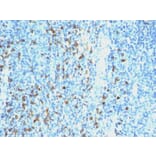 Immunohistochemistry - Anti-Lambda Light Chain Antibody [SPM559] - BSA and Azide free (A252173) - Antibodies.com
