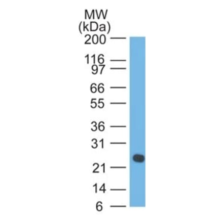 Western Blot - Anti-Lambda Light Chain Antibody [LcN-2 + ICO-106] - BSA and Azide free (A252175) - Antibodies.com