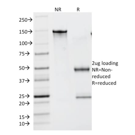 SDS-PAGE - Anti-Lambda Light Chain Antibody [N10/2] - BSA and Azide free (A252177) - Antibodies.com