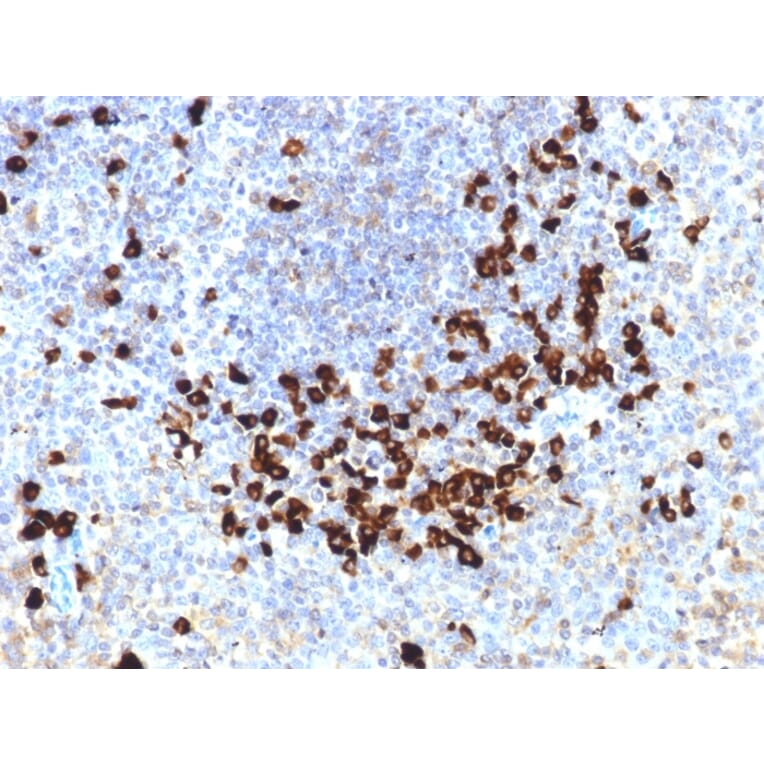 Immunohistochemistry - Anti-Lambda Light Chain Antibody [LLC/1738] - BSA and Azide free (A252178) - Antibodies.com