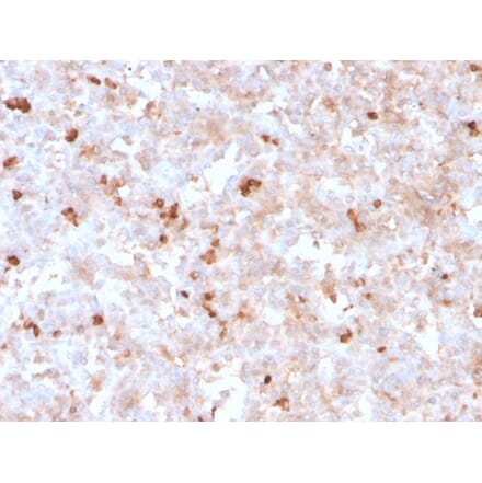 Immunohistochemistry - Anti-Lambda Light Chain Antibody [rLLC/1738] - BSA and Azide free (A252179) - Antibodies.com