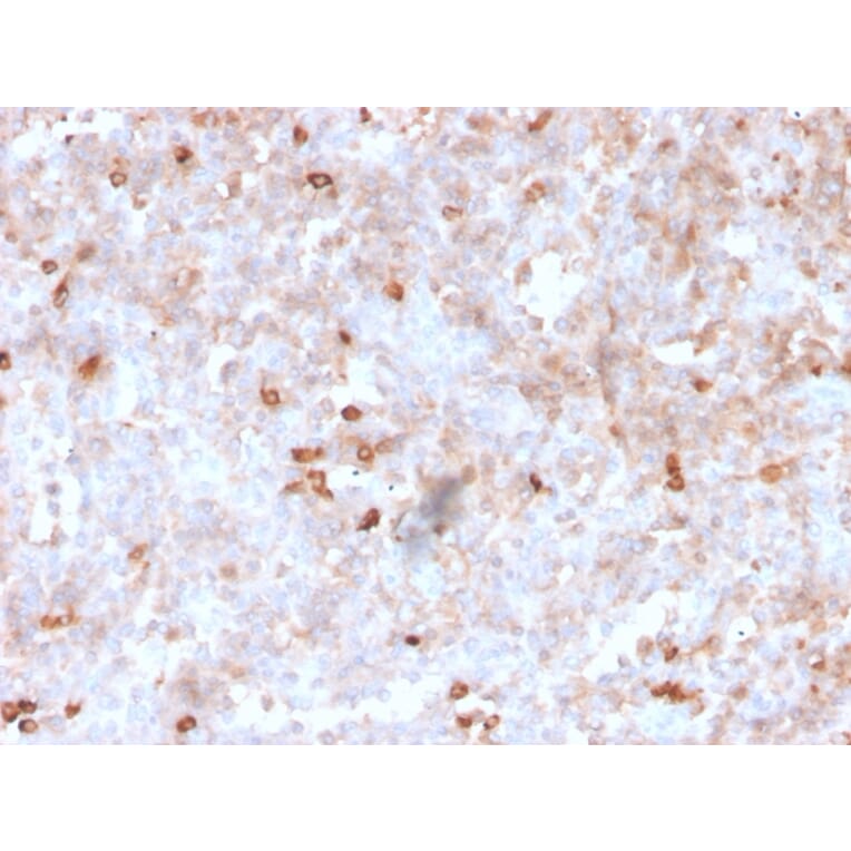 Immunohistochemistry - Anti-Lambda Light Chain Antibody [rLLC/1738] - BSA and Azide free (A252178) - Antibodies.com