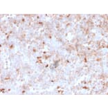 Immunohistochemistry - Anti-Lambda Light Chain Antibody [rLLC/1738] - BSA and Azide free (A252178) - Antibodies.com
