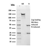 SDS-PAGE - Anti-Lambda Light Chain Antibody [rLLC/1738] - BSA and Azide free (A252179) - Antibodies.com