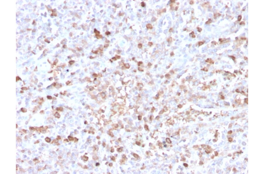 Immunohistochemistry - Anti-Lambda Light Chain Antibody [LLC/3778R] - BSA and Azide free (A252180) - Antibodies.com