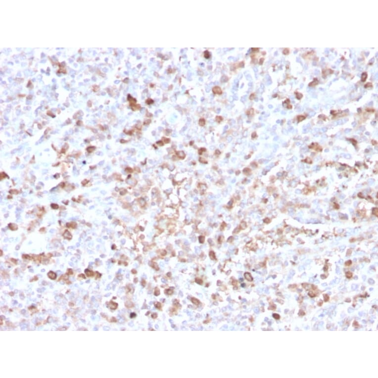Immunohistochemistry - Anti-Lambda Light Chain Antibody [LLC/3778R] - BSA and Azide free (A252180) - Antibodies.com