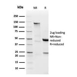 SDS-PAGE - Anti-Lambda Light Chain Antibody [LLC/3778R] - BSA and Azide free (A252180) - Antibodies.com