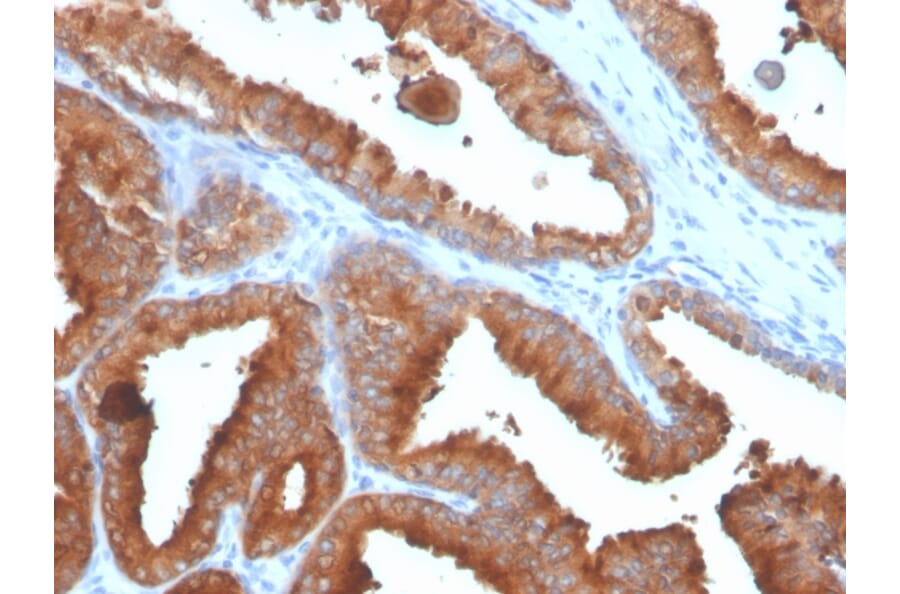 Immunohistochemistry - Anti-Prostate Specific Antigen Antibody [rKLK3/4753] - BSA and Azide free (A249001) - Antibodies.com