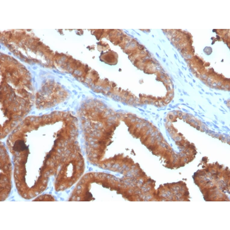 Immunohistochemistry - Anti-Prostate Specific Antigen Antibody [rKLK3/4753] - BSA and Azide free (A249001) - Antibodies.com
