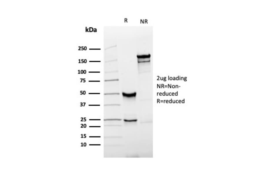 SDS-PAGE - Anti-Prostate Specific Antigen Antibody [rKLK3/4753] - BSA and Azide free (A249001) - Antibodies.com