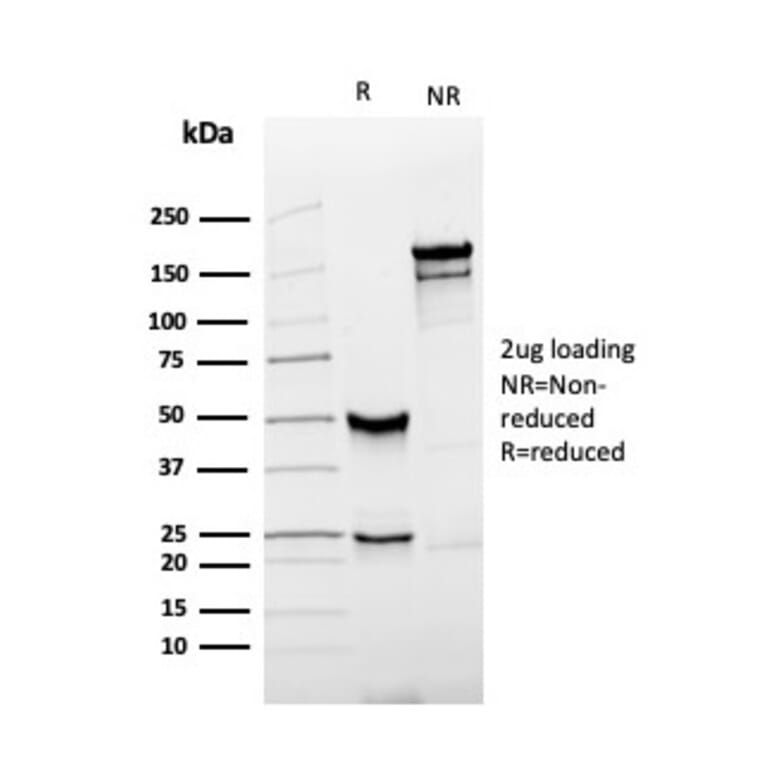 SDS-PAGE - Anti-Prostate Specific Antigen Antibody [rKLK3/4753] - BSA and Azide free (A249001) - Antibodies.com