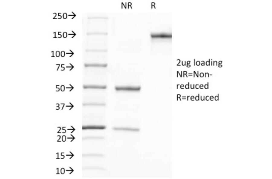 SDS-PAGE - Anti-Prostate Specific Antigen Antibody [A67-B/E3] - BSA and Azide free (A252182) - Antibodies.com