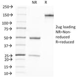 SDS-PAGE - Anti-Prostate Specific Antigen Antibody [A67-B/E3] - BSA and Azide free (A252182) - Antibodies.com