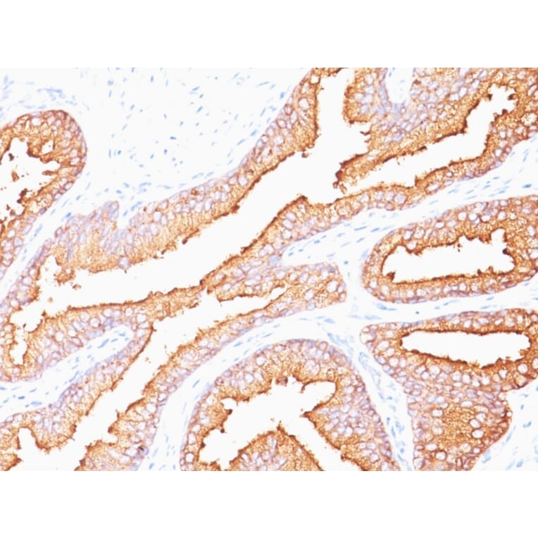 Immunohistochemistry - Anti-Prostate Specific Antigen Antibody [SPM352] - BSA and Azide free (A252182) - Antibodies.com