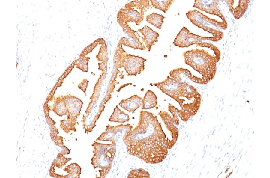 Immunohistochemistry - Anti-Prostate Specific Antigen Antibody [KLK3/801] - BSA and Azide free (A252183) - Antibodies.com