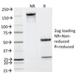 SDS-PAGE - Anti-Prostate Specific Antigen Antibody [KLK3/801] - BSA and Azide free (A252184) - Antibodies.com