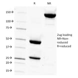 SDS-PAGE - Anti-Prostate Specific Antigen Antibody [1A7] - BSA and Azide free (A252185) - Antibodies.com