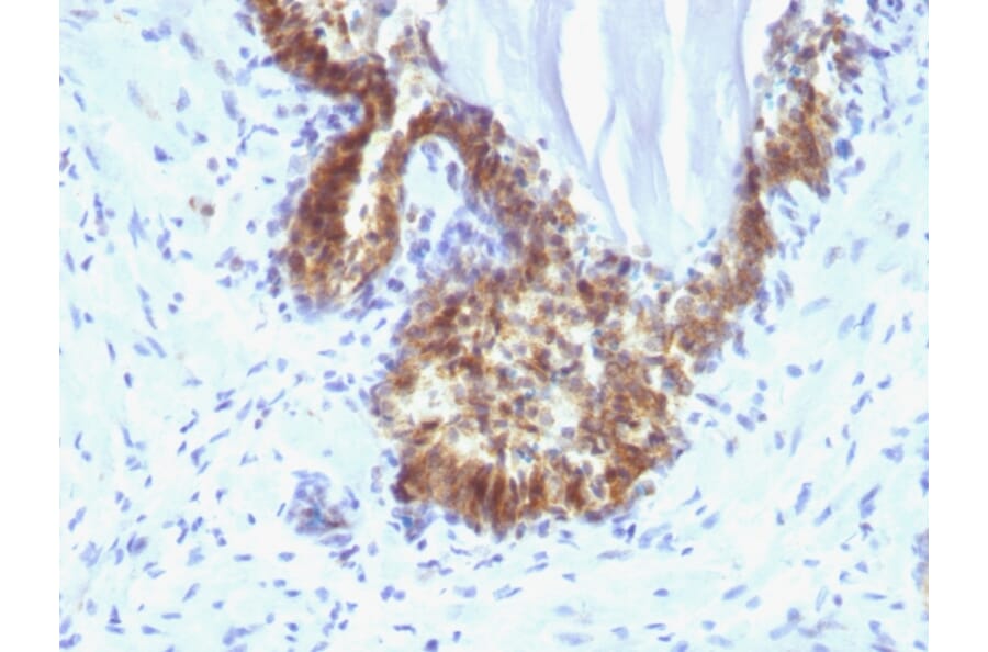 Immunohistochemistry - Anti-Prostate Specific Antigen Antibody [KLK3/1248] - BSA and Azide free (A252185) - Antibodies.com