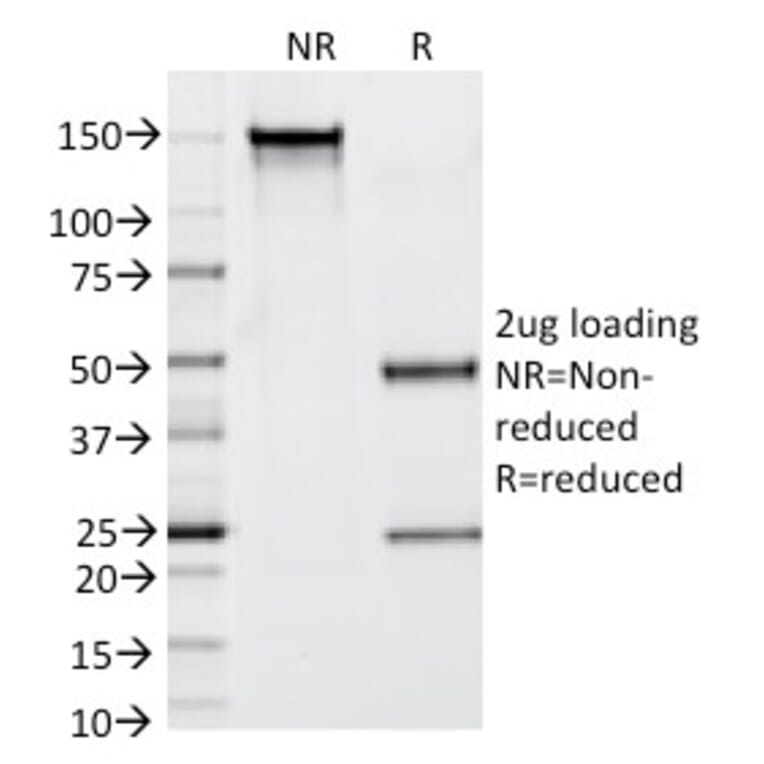 SDS-PAGE - Anti-Prostate Specific Antigen Antibody [KLK3/1248] - BSA and Azide free (A252186) - Antibodies.com