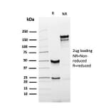 SDS-PAGE - Anti-Prostate Specific Antigen Antibody [KLK3/4551R] - BSA and Azide free (A252190) - Antibodies.com
