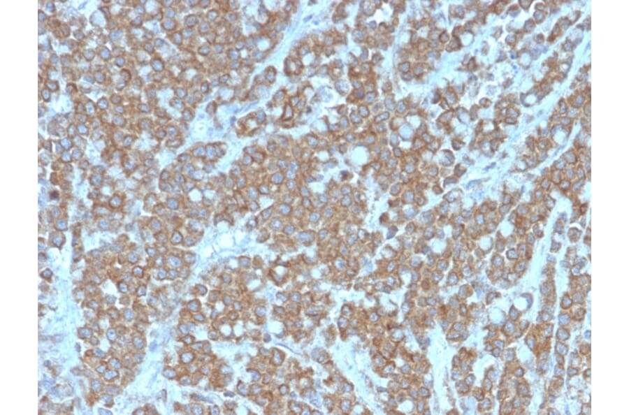 Immunohistochemistry - Anti-IL-1 alpha Antibody [IL1A/3981] - BSA and Azide free (A252192) - Antibodies.com