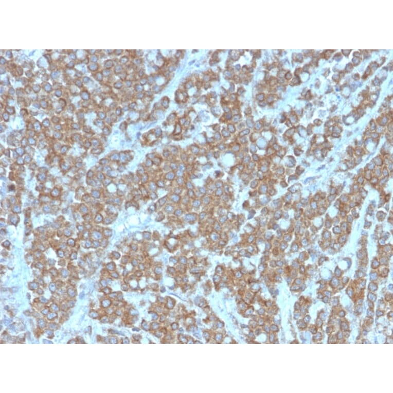 Immunohistochemistry - Anti-IL-1 alpha Antibody [IL1A/3981] - BSA and Azide free (A252192) - Antibodies.com