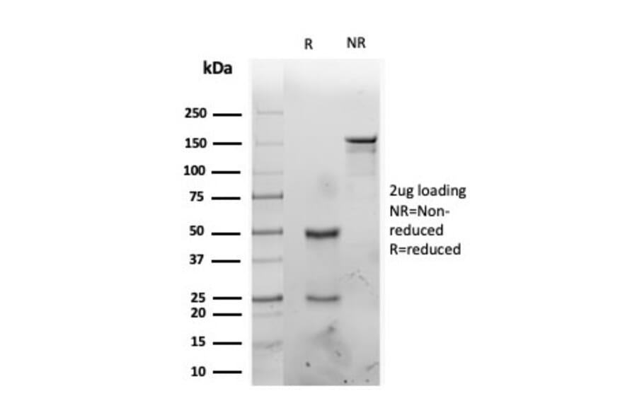 SDS-PAGE - Anti-IL-1 alpha Antibody [IL1A/3981] - BSA and Azide free (A252192) - Antibodies.com