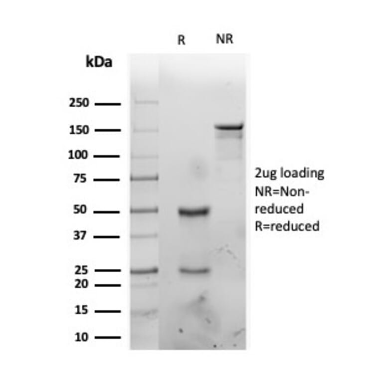 SDS-PAGE - Anti-IL-1 alpha Antibody [IL1A/3981] - BSA and Azide free (A252192) - Antibodies.com