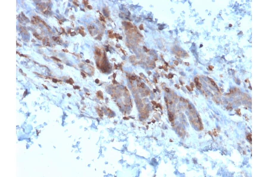 Immunohistochemistry - Anti-IL-1 alpha Antibody [IL1A/3982] - BSA and Azide free (A252193) - Antibodies.com