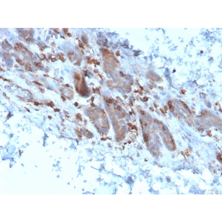 Immunohistochemistry - Anti-IL-1 alpha Antibody [IL1A/3982] - BSA and Azide free (A252193) - Antibodies.com