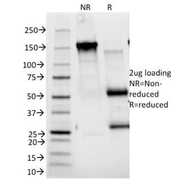 SDS-PAGE - Anti-IL2 Receptor alpha Antibody [143-13] - BSA and Azide free (A252193) - Antibodies.com