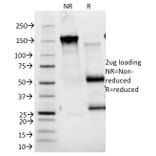 SDS-PAGE - Anti-IL2 Receptor alpha Antibody [143-13] - BSA and Azide free (A252193) - Antibodies.com