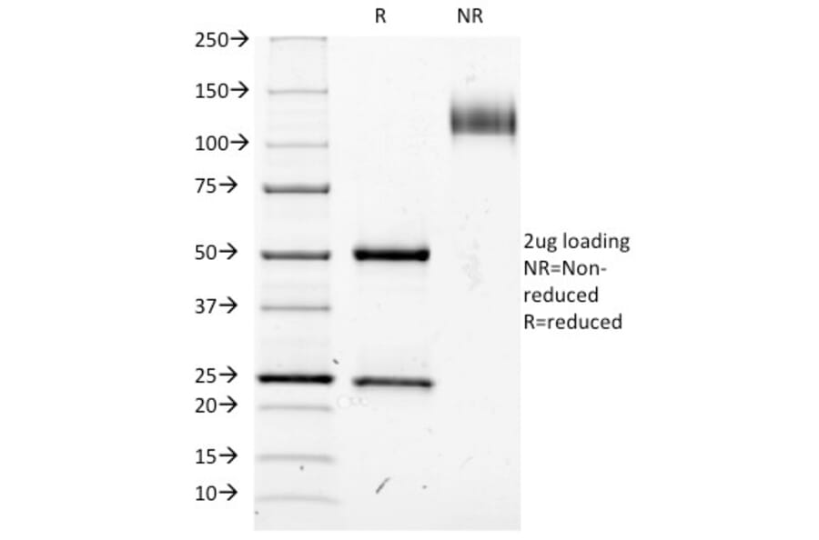 SDS-PAGE - Anti-IL2 Receptor alpha Antibody [IL2RA/423] - BSA and Azide free (A252194) - Antibodies.com