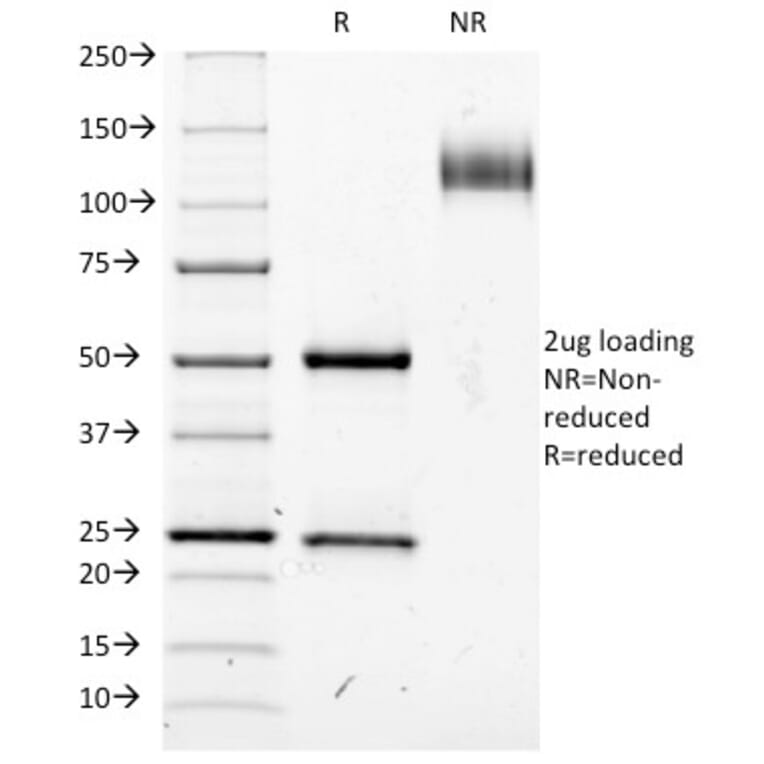SDS-PAGE - Anti-IL2 Receptor alpha Antibody [IL2RA/423] - BSA and Azide free (A252194) - Antibodies.com