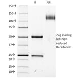 SDS-PAGE - Anti-IL2 Receptor alpha Antibody [IL2RA/423] - BSA and Azide free (A252194) - Antibodies.com