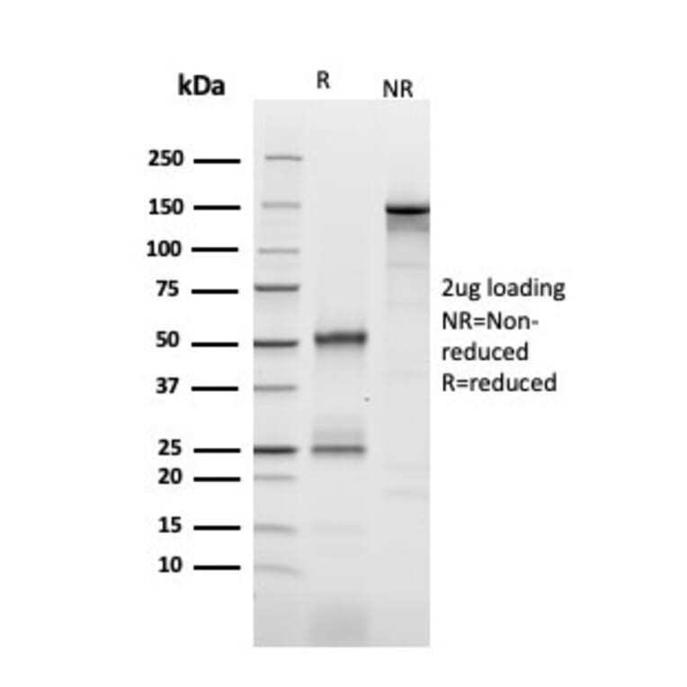 SDS-PAGE - Anti-IL2 Receptor alpha Antibody [IL2RA/2393] - BSA and Azide free (A252196) - Antibodies.com