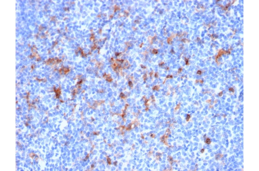 Immunohistochemistry - Anti-IL2 Receptor alpha Antibody [IL2RA/2395] - BSA and Azide free (A252198) - Antibodies.com
