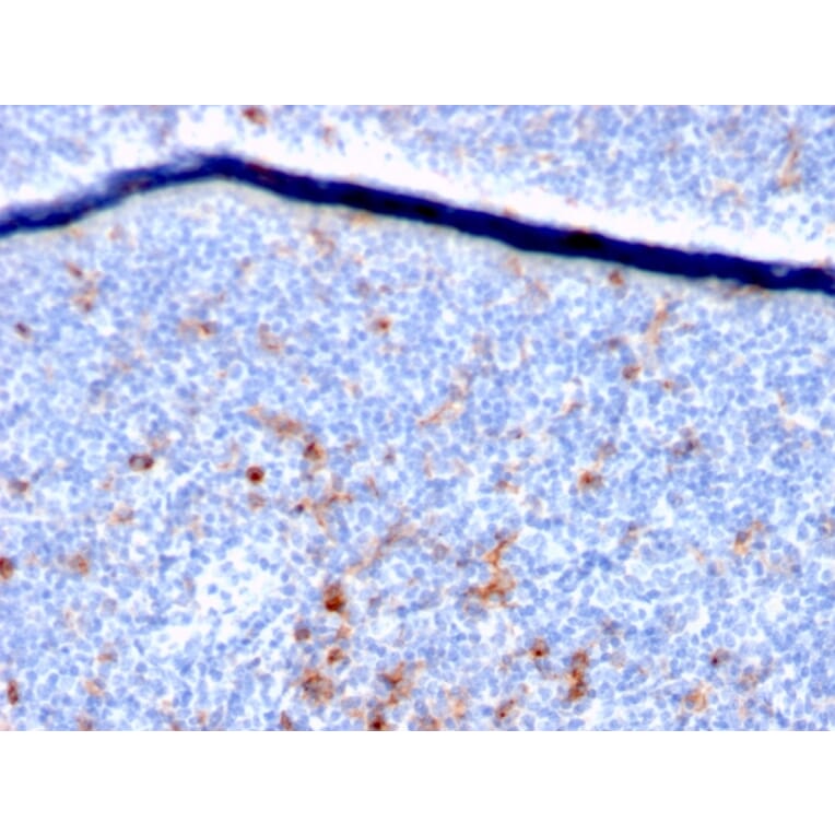 Immunohistochemistry - Anti-IL2 Receptor alpha Antibody [IL2RA/2395] - BSA and Azide free (A252198) - Antibodies.com