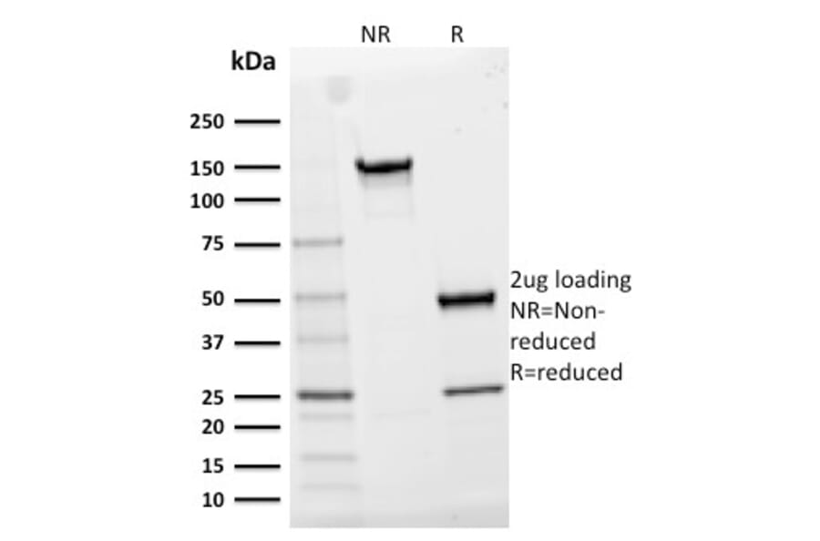 SDS-PAGE - Anti-IL2 Receptor alpha Antibody [IL2RA/2395] - BSA and Azide free (A252198) - Antibodies.com